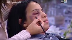 V marocké televizi radili divačkám, jak zakrýt domácí násilí.