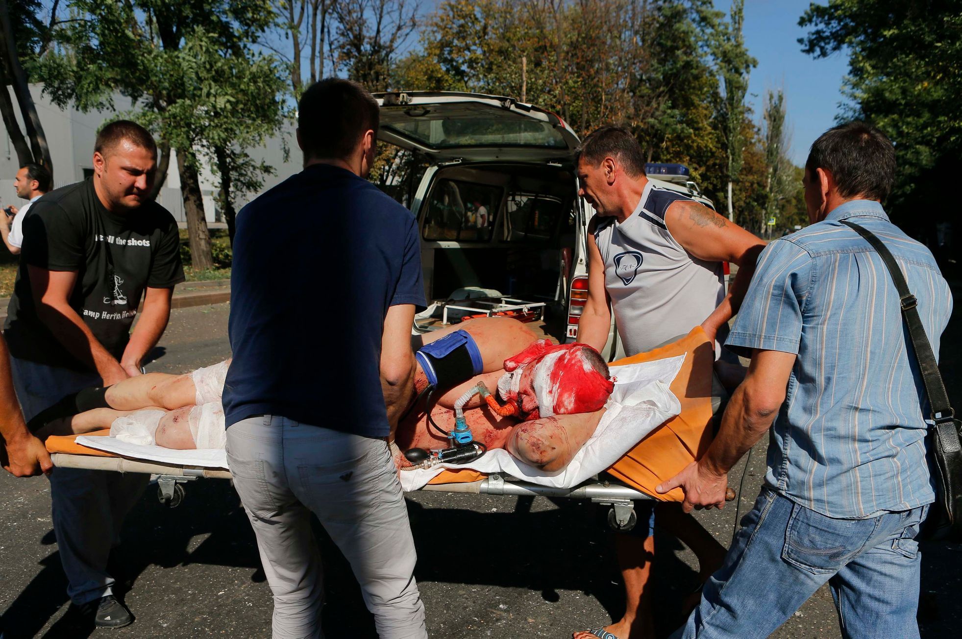 Ukrajina - Doněck - zranění