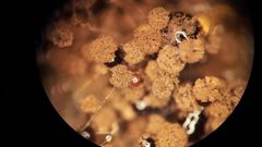 Aspergillus niger pod mikroskopem