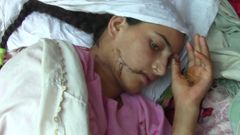 Pákistánka Nasíb jako zázrakem přežila útok svého tchána a tchýně
