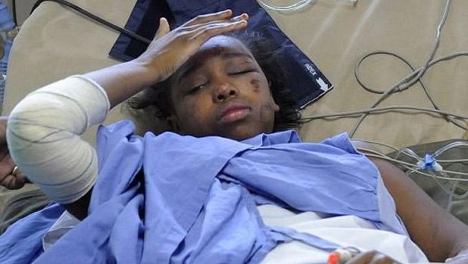 Bahia Bakariová v nemocnici po ošetření: Jediná přežila pád letadla, fyzická zranění, která utrpěla, nebyla nijak vážná.