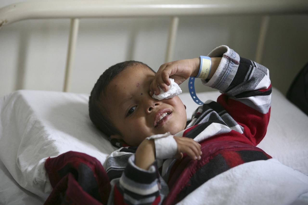 Sýrie - uprchlík - Jordánsko - zranění - chlapec