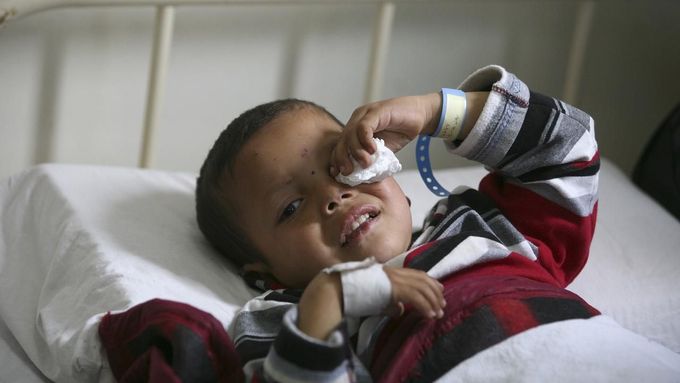 Zraněný syrský chlapec v nemocnici nedaleko jordánské metropole Ammán.