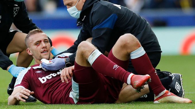 Tomáše Součka ošetřují lékaři West Hamu poté, co ho v utkání s Evertonem zasáhl soupeř kopačkou do obličeje