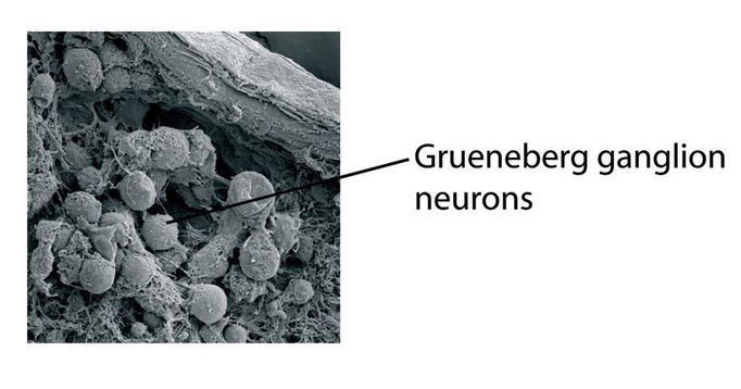 Nervové buňky v Grünebergově uzlině.