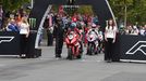 Tourist Trophy 2015: start