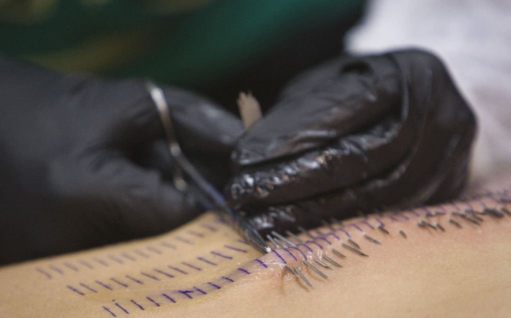 Staysha Randallová - piercing - rekord do Guinnessovy knihy rekordů