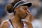 Venus Williamsovou chytly záda, omluvila se z Fed Cupu