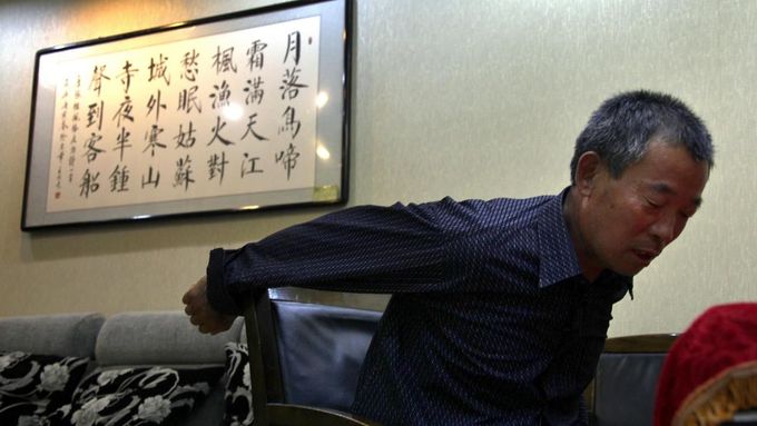 Čchen Kuang-fu, bratr slepého čínského disidenta, ukazuje, jak ho čínské bezpečnostní složky po zadržení mučily a bily.