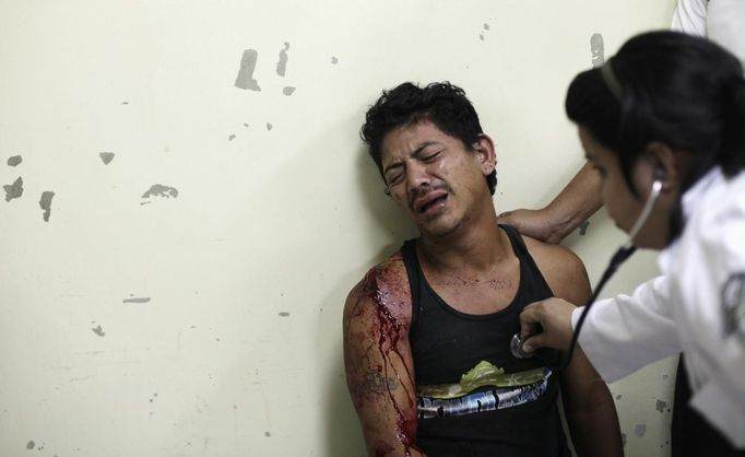 ATTENTION EDITORS - VISUAL COVERAGE OF SCENES OF INJURY OR DEATH A man reacts as a doctor treats his wounds after he had been attacked by a gang in San Pedro Sula March 28, 2013. San Pedro Sula, the country's second largest city after Tegucigalpa, has a homicide rate of 169 per 100,000 people and was named the world's most violent city for a second year in a row. Lax laws allow civilians to own up to five personal guns, and arms trafficking has flooded the country with nearly 70% illegal firearms. 83.4% of homicides are by firearm compared to 60% in the United States. Picture taken March 28, 2013 REUTERS/Jorge Cabrera (HONDURAS - Tags: CRIME LAW CIVIL UNREST HEALTH) TEMPLATE OUT. ATTENTION EDITORS: PICTURE 20 OF 39 FOR PACKAGE 'GUN CULTURE - HONDURAS' SEARCH 'HONDURAS GUN' FOR ALL IMAGES Published: Dub. 5, 2013, 11:14 dop.