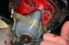 Krvavé selfie skončilo zázrakem. Teď už ukrajinský pilot F-16 takové štěstí neměl