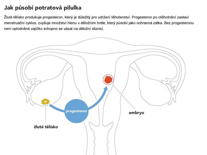 RU 486 potratová pilulka