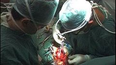 Kardiochirurgie
