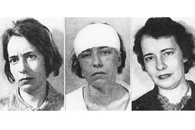 Srovnávací portréty pacientky před, těsně po a s časovým odstupem po lobotomii, USA, 40. léta. Zákrok dokumentuje změnu výrazu a osobnosti.