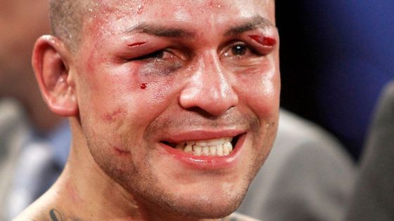 Vítězný Mike Alvarado (i takhle může vypadat zasloužený vítěz boxerského duelu)