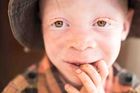 Snímek malého albína ze sirotčince v Mahangu. Andrea Růžičková říká, že je to její nejoblíbenější fotka z celé série.