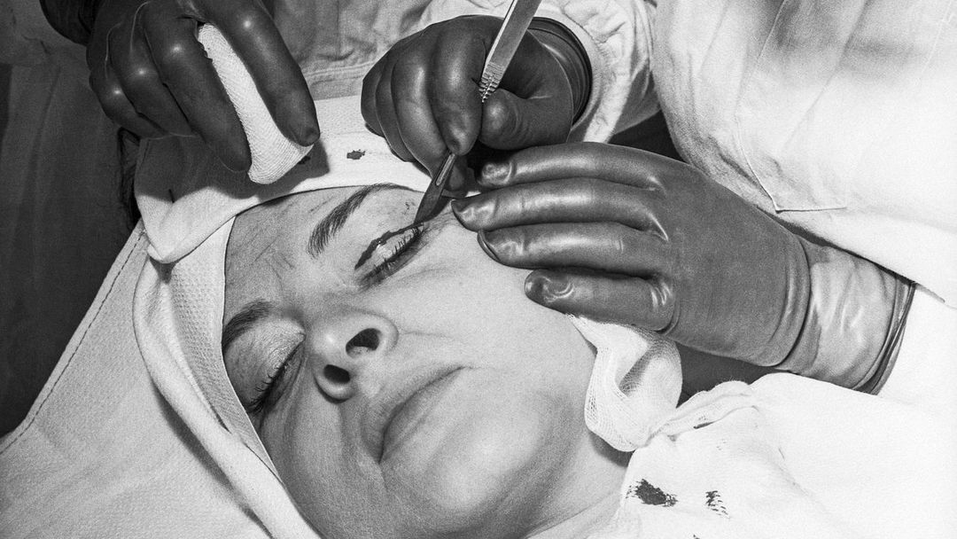 Archivní snímek z historie plastické chirurgie.