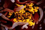 Snímek z elektronového mikroskopu zobrazuje virus SARS-CoV-2 (žlutý), který způsobuje nemoc covid-19. Virus, který je zde vidět na povrchu buňky, byl získán ze vzorku od pacienta z USA a kultivován v laboratoři amerického institutu NIAID.