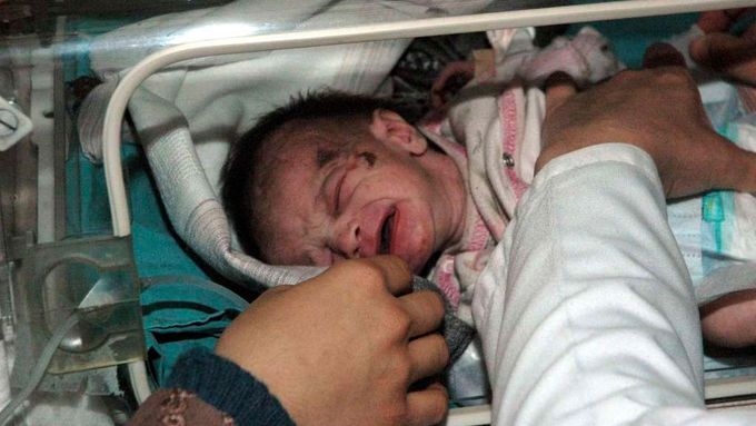 Čtrnáctidenní zachráněné novorozeně Azra Karadumanová.