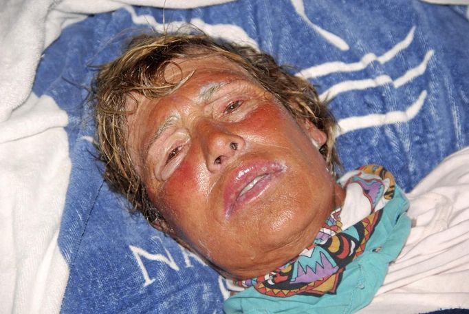 Veteran long-distance swimmer Diana Nyad rests after she was pulled out of the water between Cuba and the Florida Keys early August 21, 2012. The 62-year-old American, who battled squalls, rough seas and jellyfish, had set out from Cuba on Saturday had spend more than 60 hours in the water before she abandoned the swim. REUTERS/Christi Barli/The Florida keys News Bureau/Handout (UNITED STATES - Tags: SOCIETY) NO SALES. FOR EDITORIAL USE ONLY. NOT FOR SALE FOR MARKETING OR ADVERTISING CAMPAIGNS. THIS IMAGE HAS BEEN SUPPLIED BY A THIRD PARTY. IT IS DISTRIBUTED, EXACTLY AS RECEIVED BY REUTERS, AS A SERVICE TO CLIENTS Published: Srp. 21, 2012, 2:17 odp.