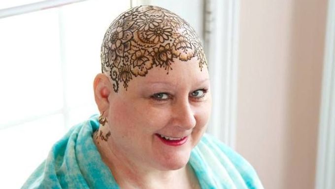 Pacientky s rakovinou se nechávají tetovat hennou