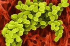 Snímek zachycuje Staphylococcus aureus neboli zlatého stafylokoka. Jde o druh grampozitivních bakterií, které ničí tkáně. Často se projevuje jako otrava jídlem.