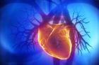 Čeští vědci pomohou vytvořit počítačový model nemocného srdce. Ukáže každou vadu v jeho fungování