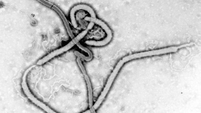 Virus eboly.