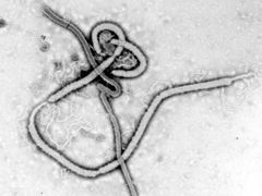 Virus Eboly zblízka.