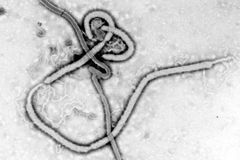 Ebola má slabinu, virus se šíří jako cholesterol