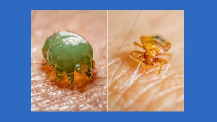 Svrab a štěnice. Dvojitá hrozba nejen z dovolené vás okrade o spánek; Zdroj foto: Aktuálně.cz / Zdrojové foto: Profimedia / Koláž: Dan Poláček