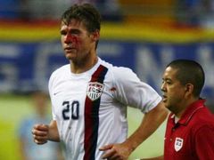 Americký útočník Brian McBride zraněný při utkání s Itálií.