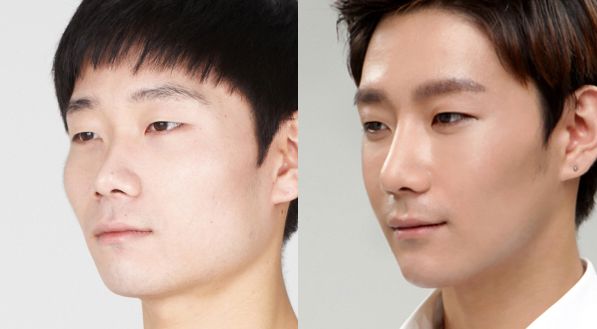 Plastické operace v Jižní Korey