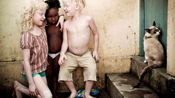 V černošské rodině se narodili tři albíni