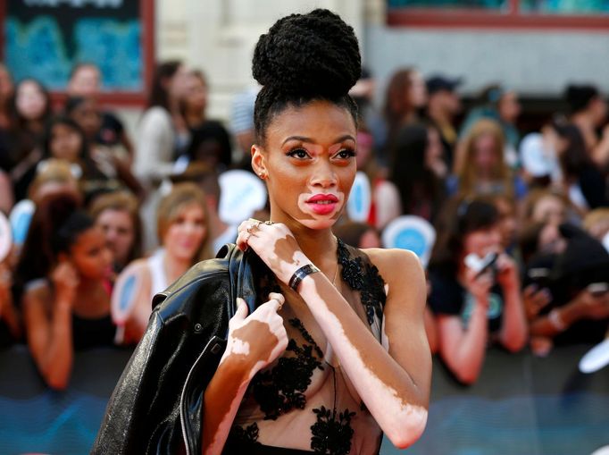 Winnie Harlow - MuchMusic Video Awards v Torontu