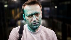 Alexej Navalnyj po útoku chemickou látkou