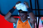 Leodový klobouček si na hlavě vytvořil i Rafael Nadal.