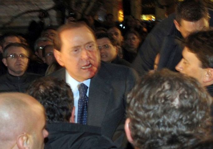 Zraněný Silvio Berlusconi opouští mítink své strany.