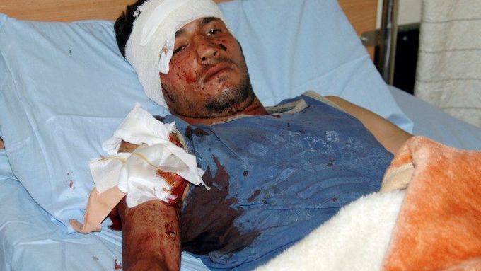 Jeden z mužů zraněných při sebevražedném pumovém útoku, k němuž došlo v Bagdádu