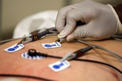 Ve Zlíně umí EKG poslat ze záchranky lékařům na mobil