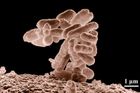 Upravená E. coli zabíjí nebezpečnou bakterii