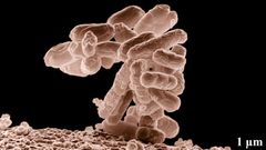 Bakterie Escherichia coli