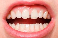 Tak tohle fakt přehrála! Za pokousání kolegy během představení dostala tučnou pokutu