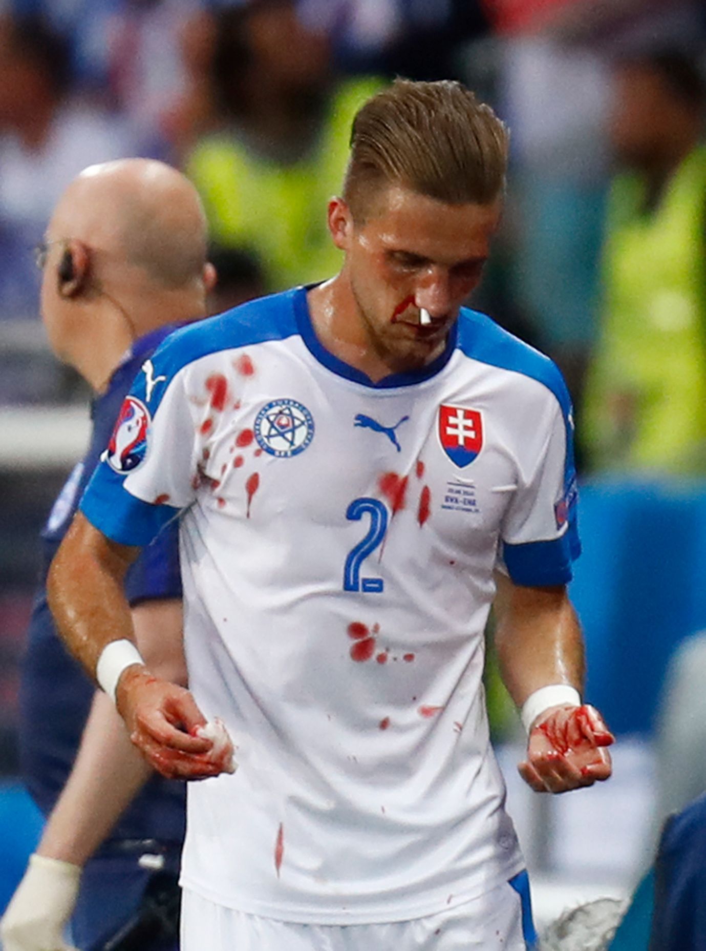Euro 2016, Slovensko-Anglie: zraněný Peter Pekarík