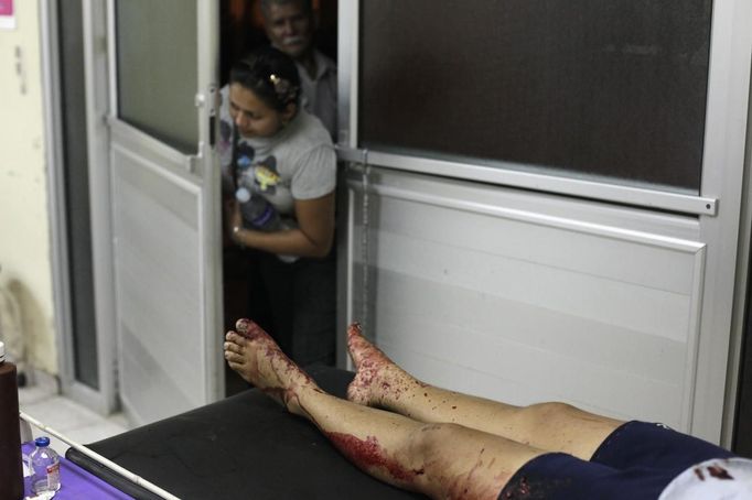 People peek into the emergency ward near the bloody legs of a woman who had been assaulted by her husband at a local hospital in San Pedro Sula March 20, 2013. San Pedro Sula, the country's second largest city after Tegucigalpa, has a homicide rate of 169 per 100,000 people and was named the world's most violent city for a second year in a row. Lax laws allow civilians to own up to five personal guns. Arms trafficking has flooded the country with nearly 70% illegal firearms. 83.4% of homicides are by firearms, compared to 60% in the United States. Picture taken March 20, 2013. REUTERS/Jorge Cabrera (HONDURAS - Tags: CRIME LAW CIVIL UNREST HEALTH) ATTENTION EDITORS: PICTURE 15 OF 39 FOR PACKAGE 'GUN CULTURE - HONDURAS' SEARCH 'HONDURAS GUN' FOR ALL IMAGES Published: Dub. 5, 2013, 11:14 dop.