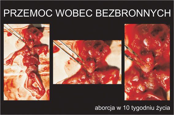 Vyber život - výstava - potrat
