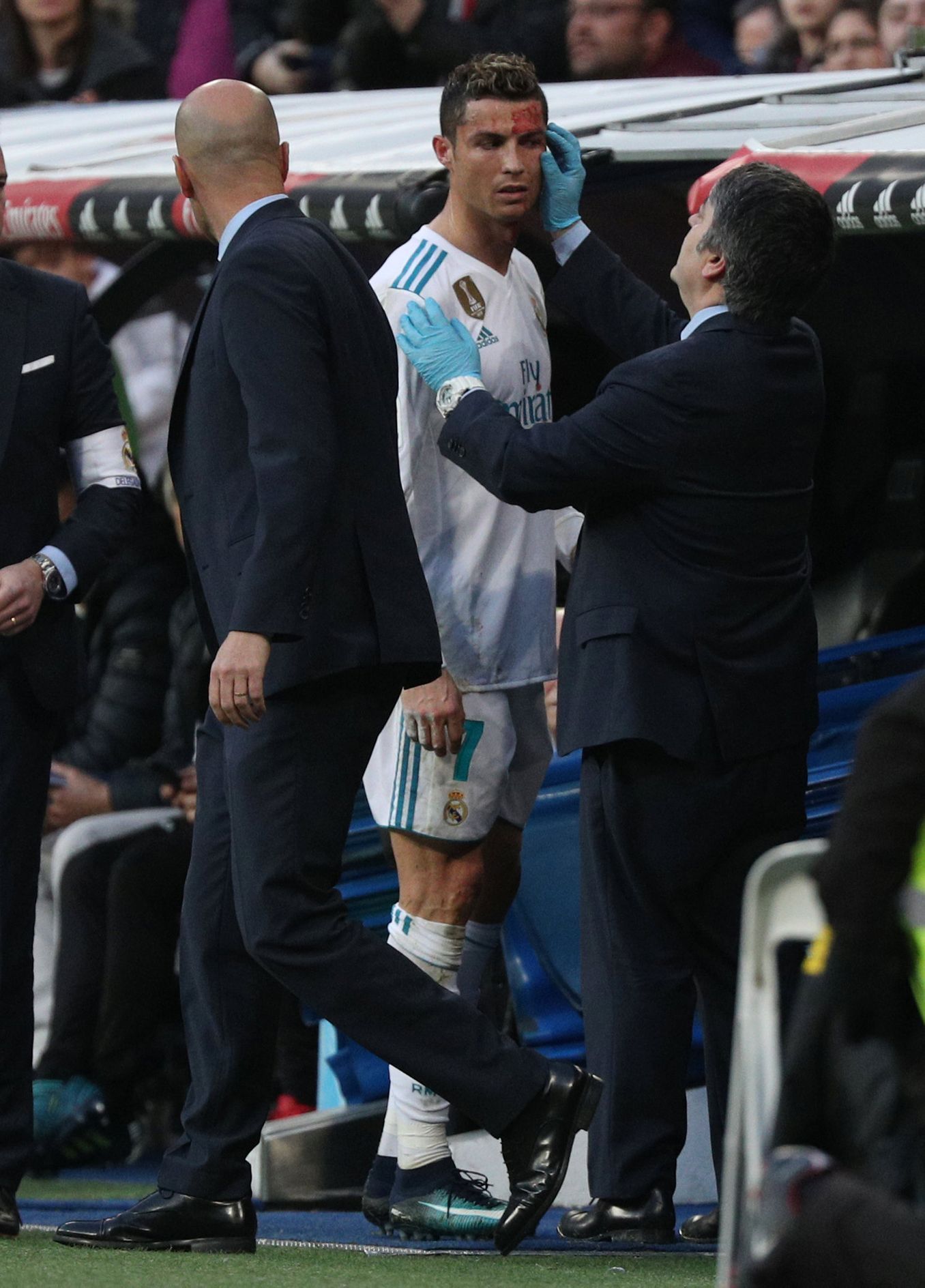Zraněný Ronaldo