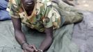 Injured South Sudan SPLA soldier lies outside a hospital in Bentiu