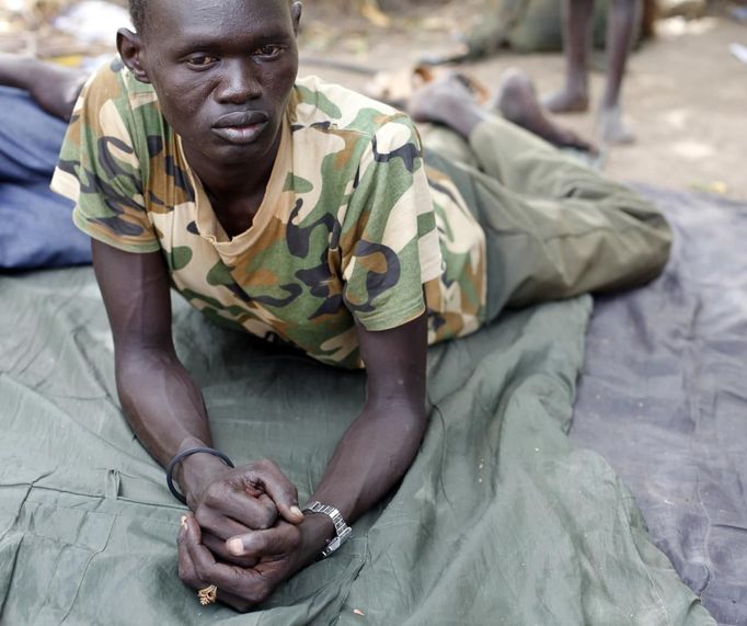 Injured South Sudan SPLA soldier lies outside a hospital in Bentiu