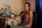 Obrazem: Synek mi málem umřel. Venezuelané trpí hlady, shodili i třetinu své váhy